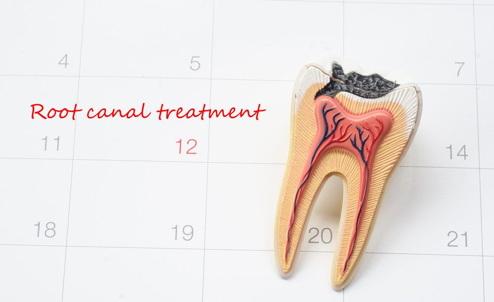 Root Canal Therapy: An Important General Dentistry Procedure